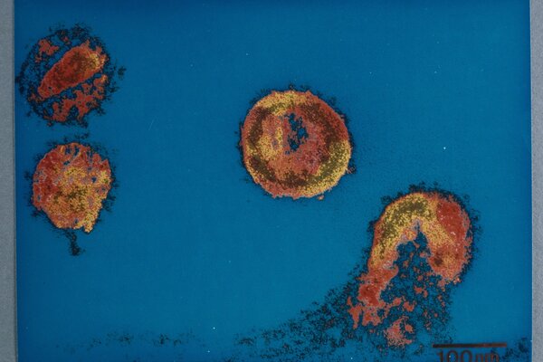 © Charles DAUGUET / CNRS Images